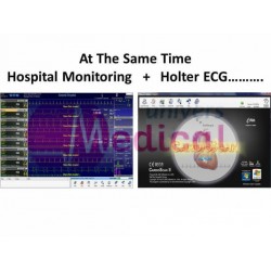 CardioScan Holter ECG Système